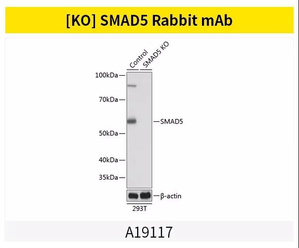 《Smads家族蛋白如何精准调控TGF-β信号转导》