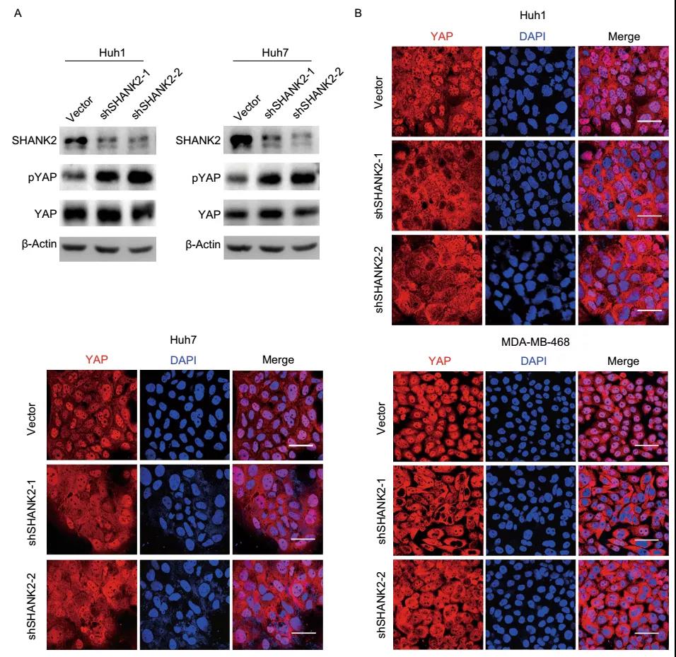 《姜海和张雷研究组合作发现一个调控HIPPO通路的新型原癌基因- SHANK2》